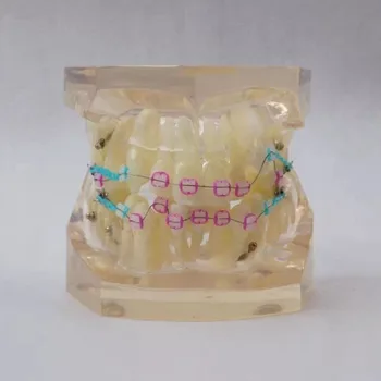 24pcs Dantys visi keramikos laikiklis Ortodontija, Dantų Modelis