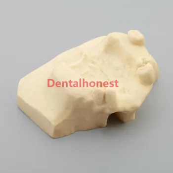 Aukštos kokybės Dantų Sinuso Pakėlimo Praktikos Dantų Modelio Typodont Studijų Modelį 2013F Modelis