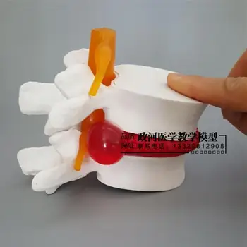Medicinos žmogaus juosmens disko ligos pristatymas modelis Ortopedijos stuburo modelis