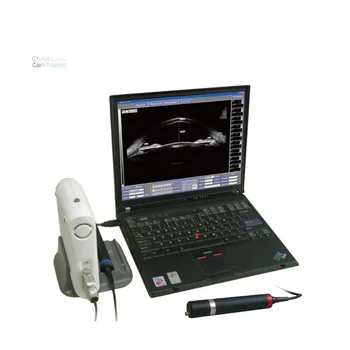 Oftalmologijos Nešiojamų UBM SW-3200S su CE, FDA Skalės UBM Oftalmoskopija Ląstelių Skaitytuvas
