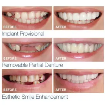 Viršutinės Klaidingas, Netikras Dantis Padengti Snap Nedelsiant Šypsena Kosmetikos Dantų Protezų Priežiūros Grožio Priemonė