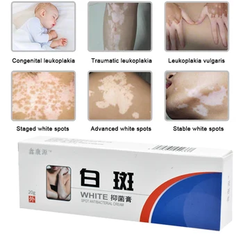 20g Kinų Medicinos Balta Dėmė Ligos Kremas Pigmento Melanino Skatinti Liniment Odos Vitiligo Leukoplakia Ligos Gydymas