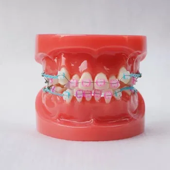 24pcs Dantys visi keramikos laikiklis Ortodontija, Dantų Modelis